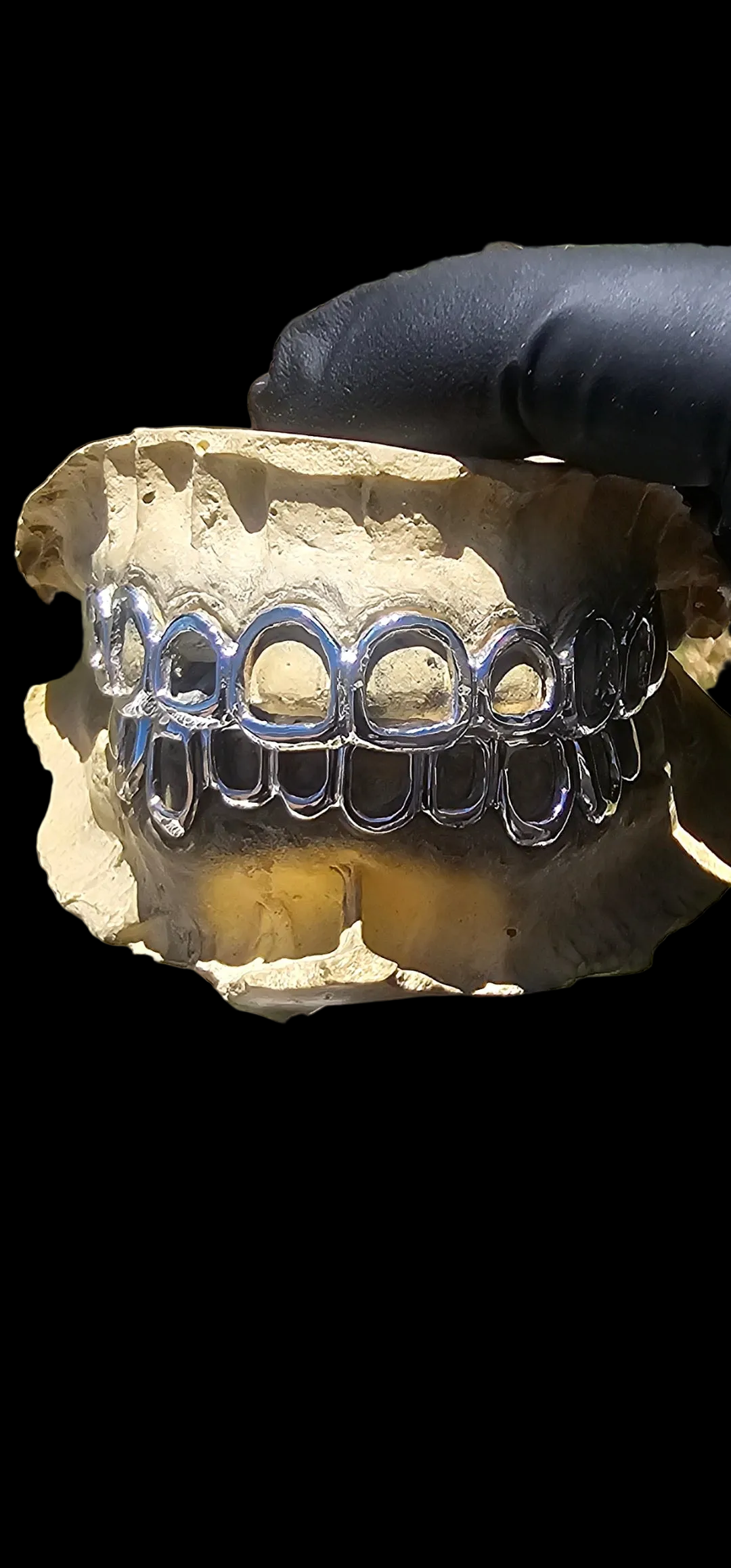 Open Face Grillz